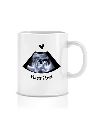 Personalizovaný klasický biely keramický hrnček s objemom 300 ml vyrobený ultrazvukovou technológiou Personalizovaný klasický biely keramický hrnček s objemom 300 ml vyrobený ultrazvukovou technológiou