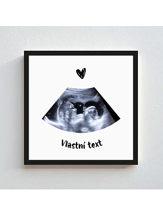 Personalizovaný magický fotob obraz v ráme – štvorcový 20x20 – ultrazvuk