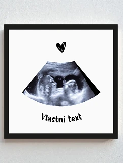Personalizovaný magický fotob obraz v ráme – štvorcový 20x20 – ultrazvuk