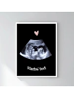 Personalizovaný magický fotorámik – 30x40 – ultrazvuk Personalizovaný magický fotorámik – 30x40 – ultrazvuk