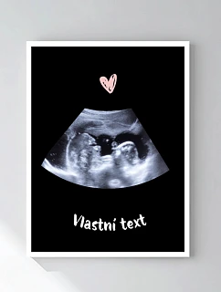 Personalizovaný magický fotorámik – 30x40 – ultrazvuk