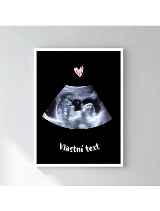 Personalizovaný magický fotorámik – 30x40 – ultrazvuk Personalizovaný magický fotorámik – 30x40 – ultrazvuk