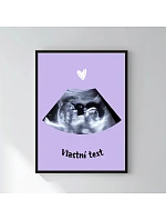 Personalizovaný magický fotorámik – 30x40 – ultrazvuk Personalizovaný magický fotorámik – 30x40 – ultrazvuk