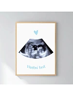 Personalizovaný magický fotorámik – 30x40 – ultrazvuk Personalizovaný magický fotorámik – 30x40 – ultrazvuk