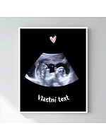 Personalizovaný magický fotorámik – 40x50 – ultrazvuk Personalizovaný magický fotorámik – 40x50 – ultrazvuk