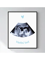 Personalizovaný magický fotorámik – 40x50 – ultrazvuk Personalizovaný magický fotorámik – 40x50 – ultrazvuk