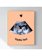 Personalizovaný magický fotorámik – 40x50 – ultrazvuk Personalizovaný magický fotorámik – 40x50 – ultrazvuk