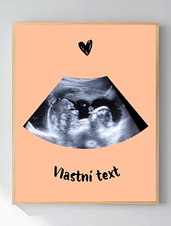 Personalizovaný magický fotorámik – 40x50 – ultrazvuk