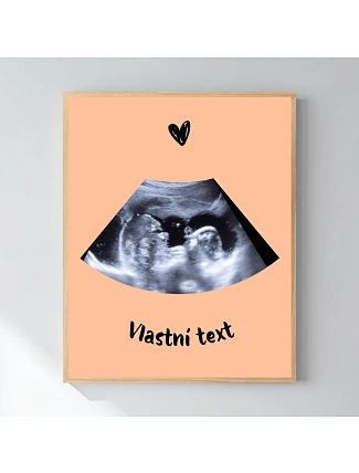 Personalizovaný magický fotorámik – 40x50 – ultrazvuk Personalizovaný magický fotorámik – 40x50 – ultrazvuk