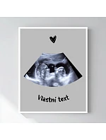 Personalizovaný magický fotob obraz v ráme – 50 × 70 – ultrazvuk
