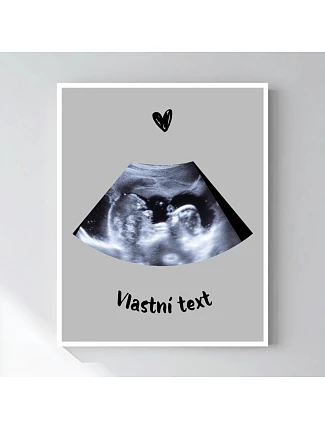 Personalizovaný magický fotob obraz v ráme – 50 × 70 – ultrazvuk
