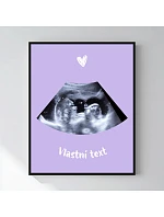 Personalizovaný magický fotob obraz v ráme – 50 × 70 – ultrazvuk