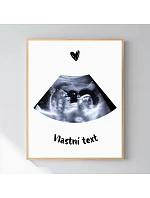 Personalizovaný magický fotob obraz v ráme – 50 × 70 – ultrazvuk