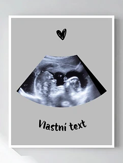 Personalizovaný magický fotob obraz v ráme – 50 × 70 – ultrazvuk