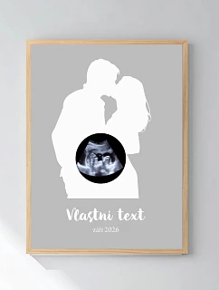 Personalizovaný magický fotorámik – štvorcový 30x40 – s párom a ultrazvukom
