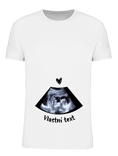 Personalizované dámske tričko – ultrazvuk